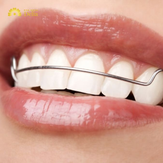 Hàm duy trì tháo lắp là như thế nào, khi nào cần sử dụng?