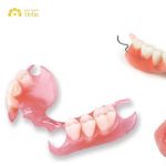 Hàm tháo lắp là gì? Ưu nhược điểm khi dùng hàm tháo lắp