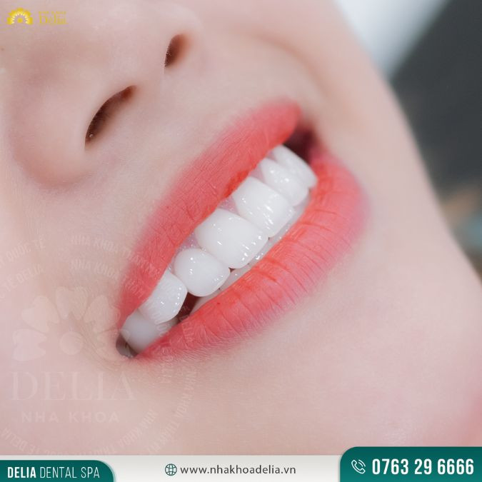 Khách hàng bọc răng sứ Venus đánh giá gì? Tốt hay không?