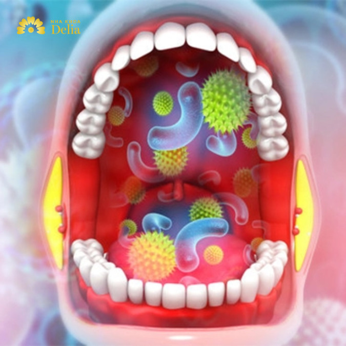 Giải mã quá trình vi khuẩn sâu răng phát triển và gây hại cho răng?