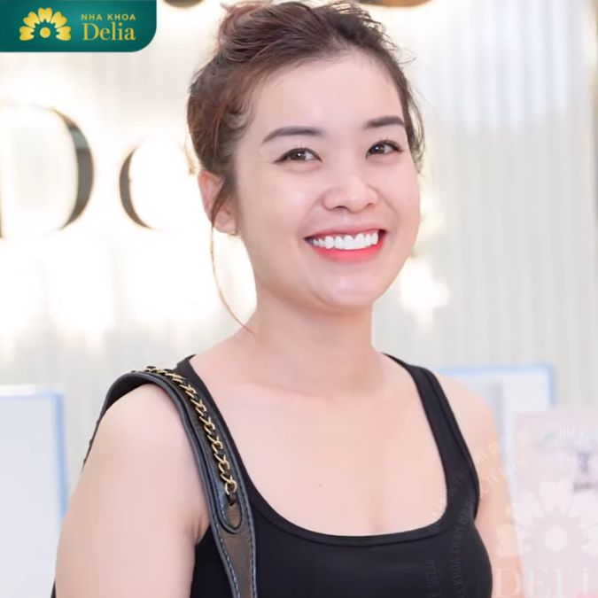 Chị Huyền Nga tìm đến delia để biến giấc mơ về nụ cười hoàn hảo thành sự thật