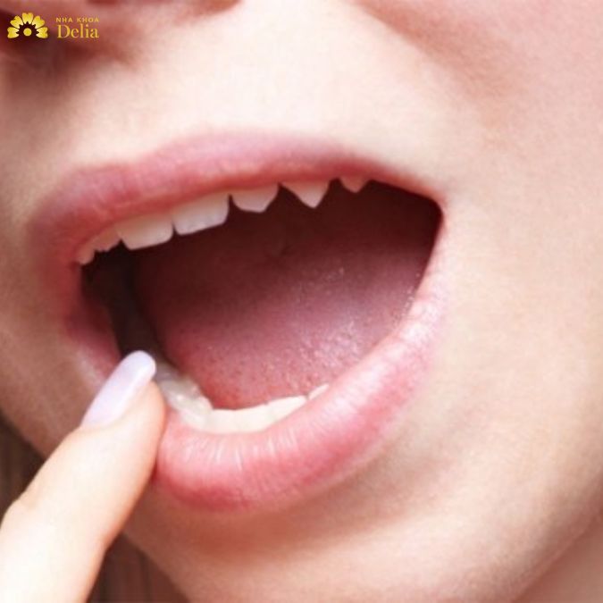 Chia sẻ những cách trị hôi miệng sau 1 đêm đơn giản nhất