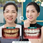 Delia - Điểm đến hoàn hảo cho nụ cười tỏa sáng