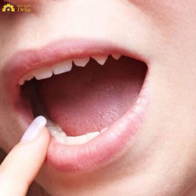 Kiếm tìm giải pháp cải thiện khuôn mặt bị lệch khi chụp ảnh