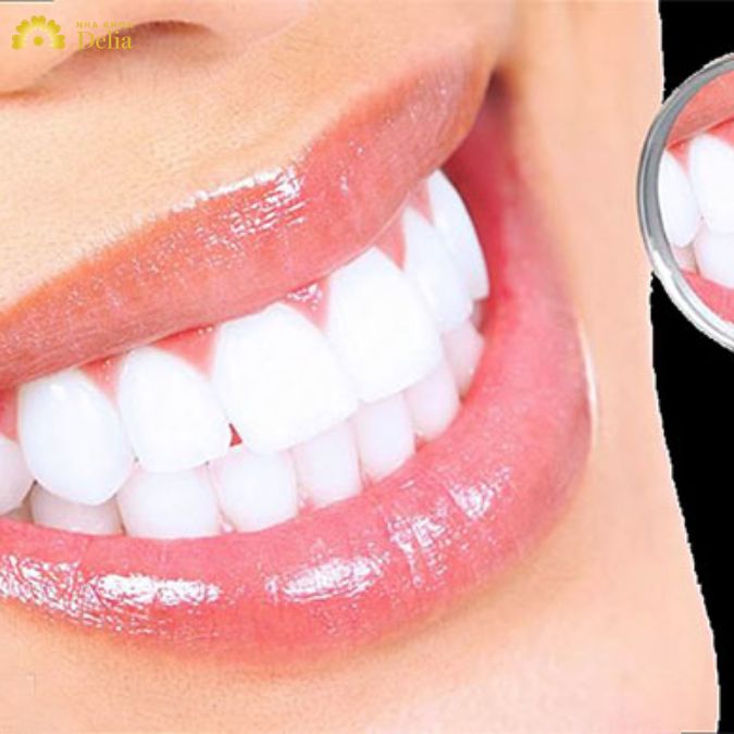 TOP 4 sản phẩm thuốc tẩy trắng răng tốt nhất năm 2024