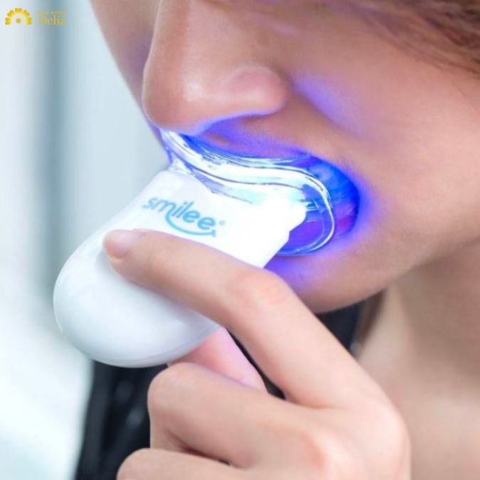 Review máy làm trắng răng Smilee chi tiết nhất từ A đến Z