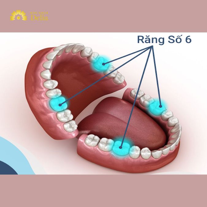 Răng số 6 có mọc lại không? Làm gì khi bị mất răng số 6?