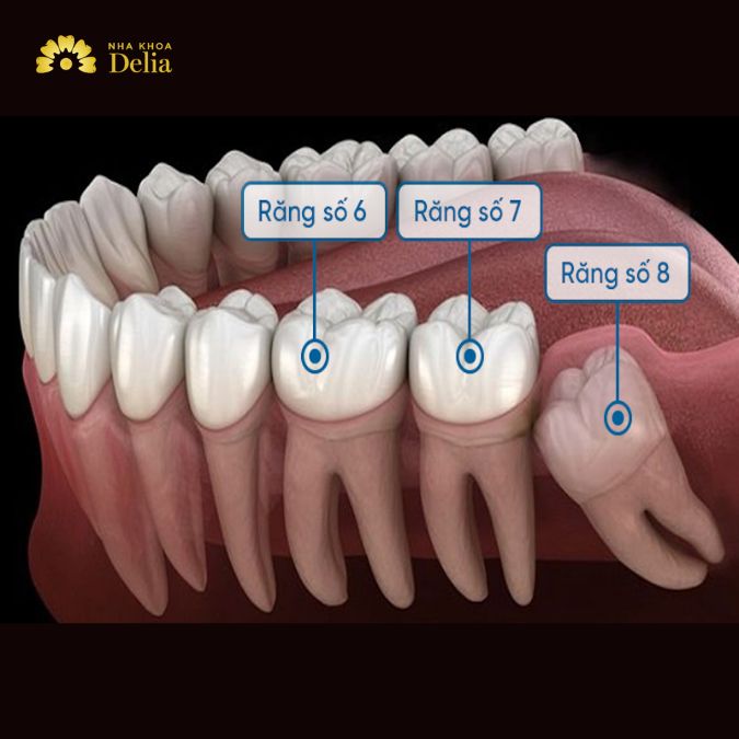 Răng số 7 bị sâu vỡ có nguy hiểm không, xử lý như thế nào?