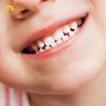 Thứ tự thay răng sữa ở trẻ và những điều cha mẹ cần biết