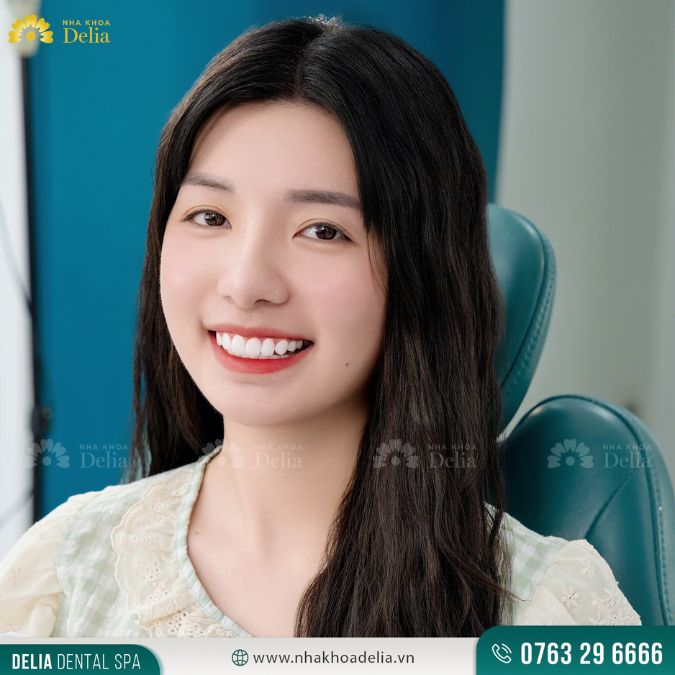 Nụ cười rạng rỡ của chị kim anh sau khi làm răng sứ Lava Plus tại Delia