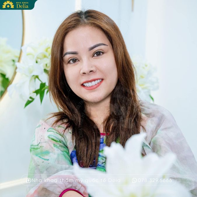 Răng sứ tài lộc – Cải thiện cuộc sống, vận may gõ cửa