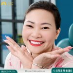 Chị Minh Anh - Thẩm mỹ răng sứ Emax