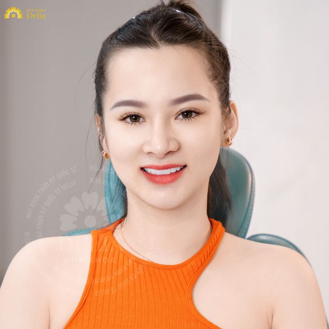 Ưu đãi tháng 5: Bọc răng sứ cao cấp Đức giá tốt nhất năm