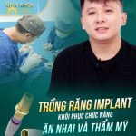 Chàng trai trẻ tuổi mất răng đã phục hình tại Delia như thế nào? Anh Phạm Bá Huy