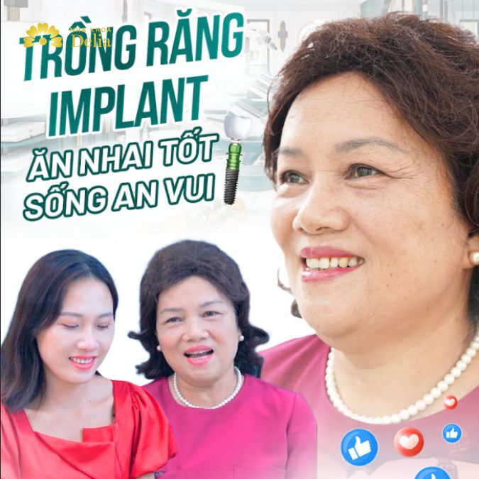 Trồng răng Implant ăn nhai tốt, sống an vui với cô Hòa U70