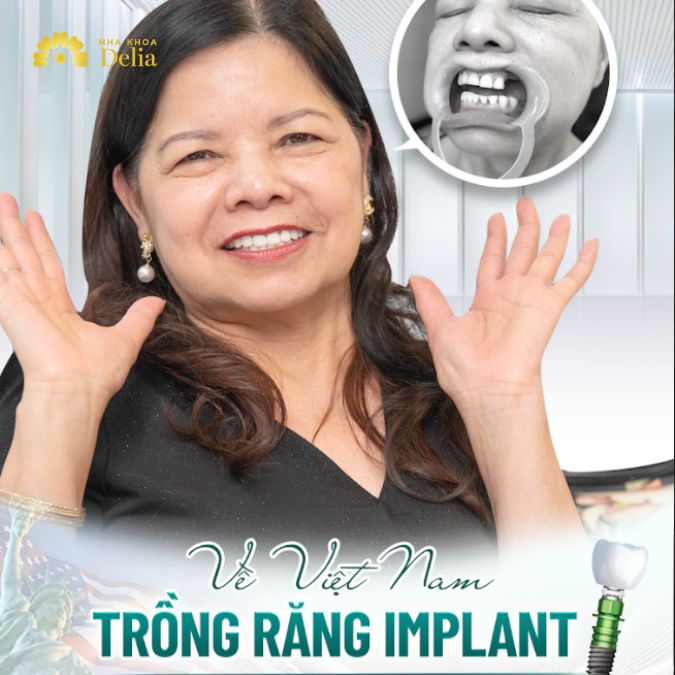 Về Việt Nam trồng răng Implant chỉ 2 lần hẹn, ăn nhai trọn đời – Cô Mai Anh