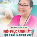 Hành trình phục hồi hàm răng đã mất của NSƯT Kim Xuyến