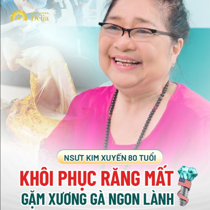 Hành trình phục hồi hàm răng đã mất của NSƯT Kim Xuyến