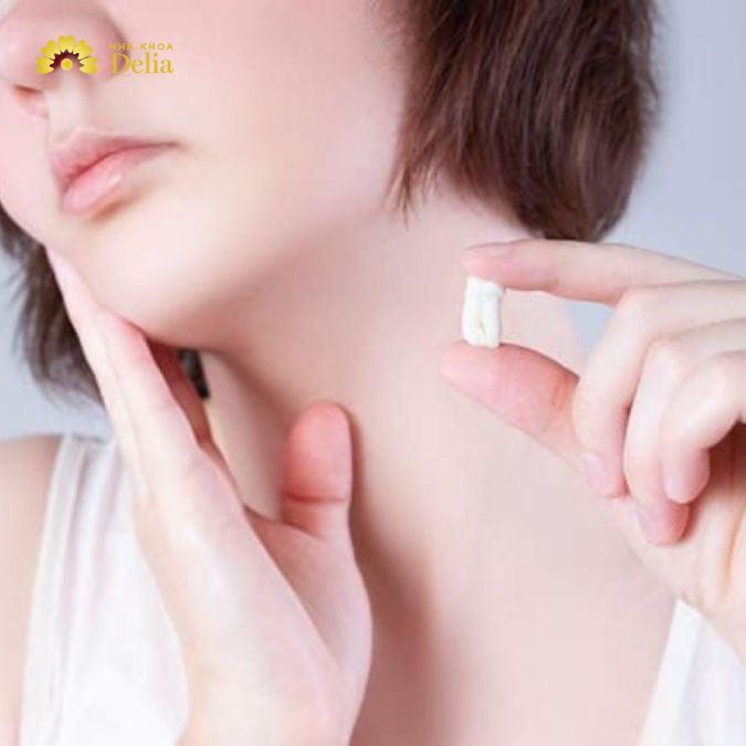 Mọc răng khôn bị sưng má nguyên nhân, dấu hiệu và cách xử lý