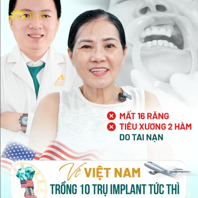 Việt kiều Mỹ Trương Tài Nga về Việt Nam trồng 10 trụ Implant tức thì