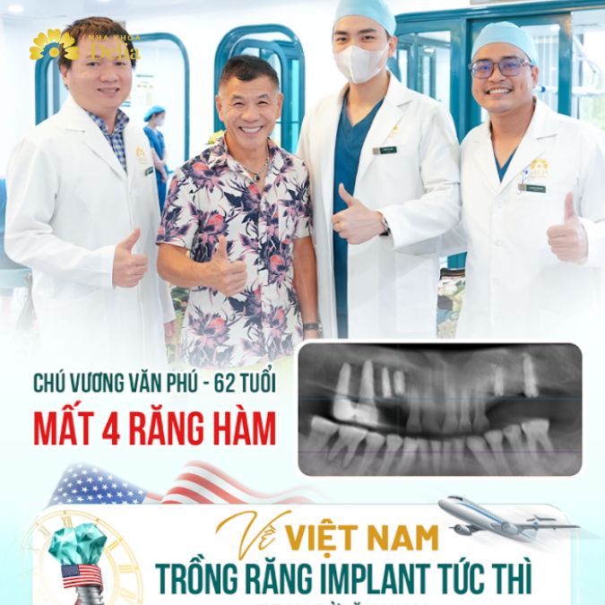 KH Vương Văn Phú Việt kiều Canada về Việt Nam trồng răng Implant tức thì – Trọn đời ăn nhai
