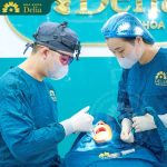 Procedure for Immediate Dental Implants