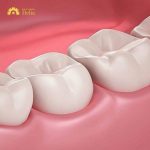 Răng nhai là răng nào? Tổng hợp thông tin đầy đủ về răng nhai