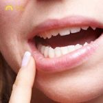 Răng nhai lung lay sẽ khiến bạn gặp khó khăn trong việc nhai thức ăn