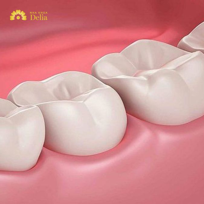 Răng nhai là răng nào? Tổng hợp thông tin đầy đủ về răng nhai