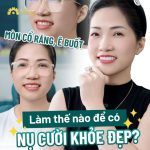 Mòn cổ răng, ê buốt làm thế nào để có nụ cười đẹp? Chị Hương, Sơn Tây