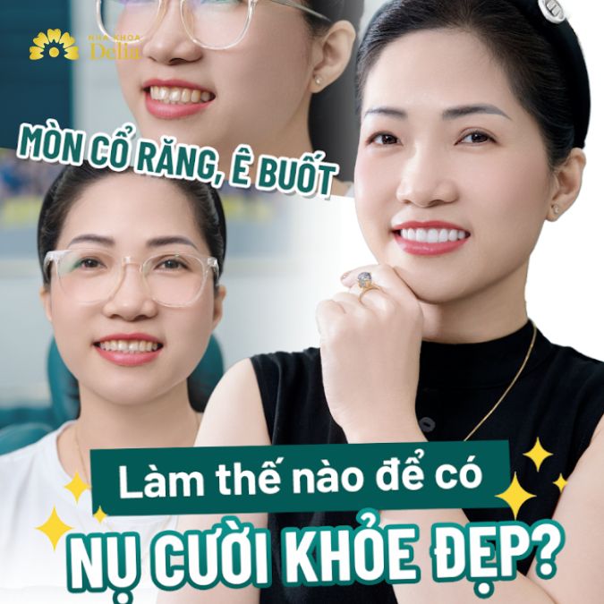 Mòn cổ răng, ê buốt làm thế nào để có nụ cười đẹp? Chị Hương, Sơn Tây