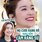 Chị Huyền Nga với vẻ rạng rỡ sau khi làm răng sứ tại Delia