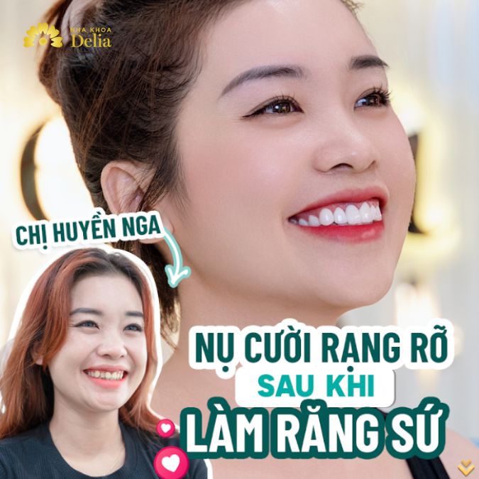 Chị Huyền Nga với vẻ rạng rỡ sau khi làm răng sứ tại Delia