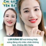 Chị gái Yên Bái: Làm răng sứ mà không thấy xứng đáng chị chắc chắn không làm