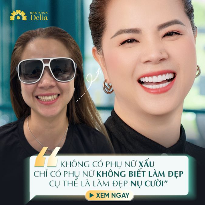 Không hài lòng với kết quả làm răng sứ tại Mỹ, chị Jean Nguyễn quyết định đến với Delia