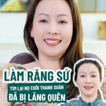 Làm răng sứ tìm lại nụ cười thanh xuân bị lãng quên - Chị Thiện Duyên