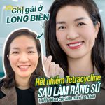 Chị gái ở Long Biên hết nhiễm Tetracycline sau khi làm răng sứ tại Delia