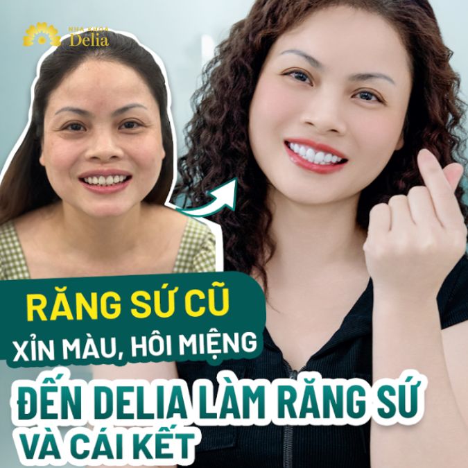 Răng sứ cũ xỉn màu, hôi miệng, đến Delia làm răng sứ và cái kết