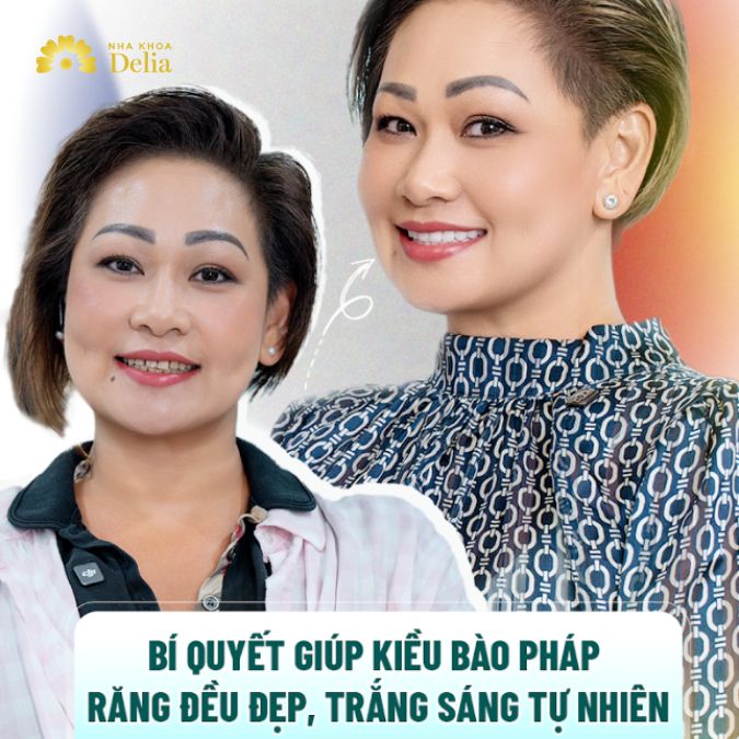 Bí quyết giúp kiều bào Pháp răng đều đẹp, trắng sáng tự nhiên