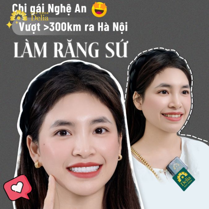 Chị gái Nghệ An vượt 300km ra Hà Nội làm răng sứ và cái kết