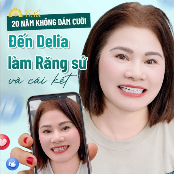 20 năm không cười, đến Delia làm răng sứ và cái kết