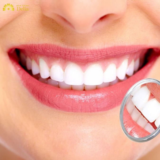 5 Lưu ý chăm sóc răng miệng ngày tết bạn cần biết