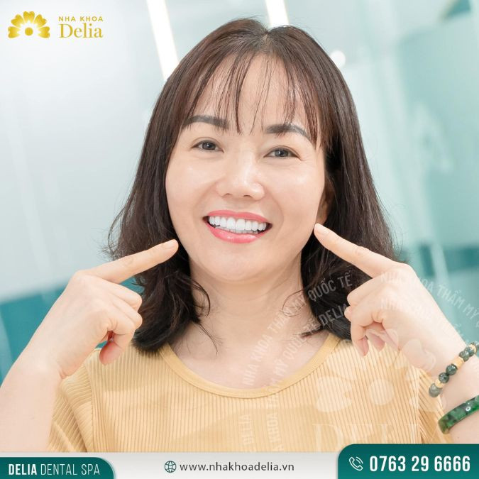 Quy trình trồng răng cửa giá bao nhiêu, đắt hay rẻ?