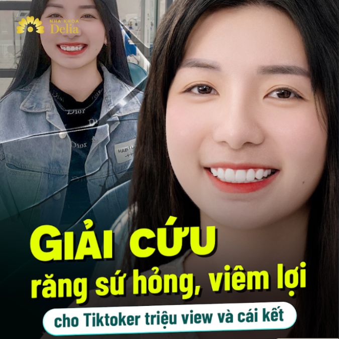 Giải cứu răng sứ hỏng, viêm lợi cho Tiktoker triệu view và cái kết – Chị Duyên