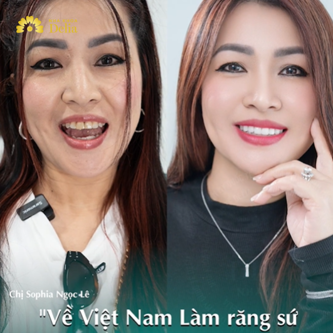 Discover the benefits of dental tourism Singapore for quality care