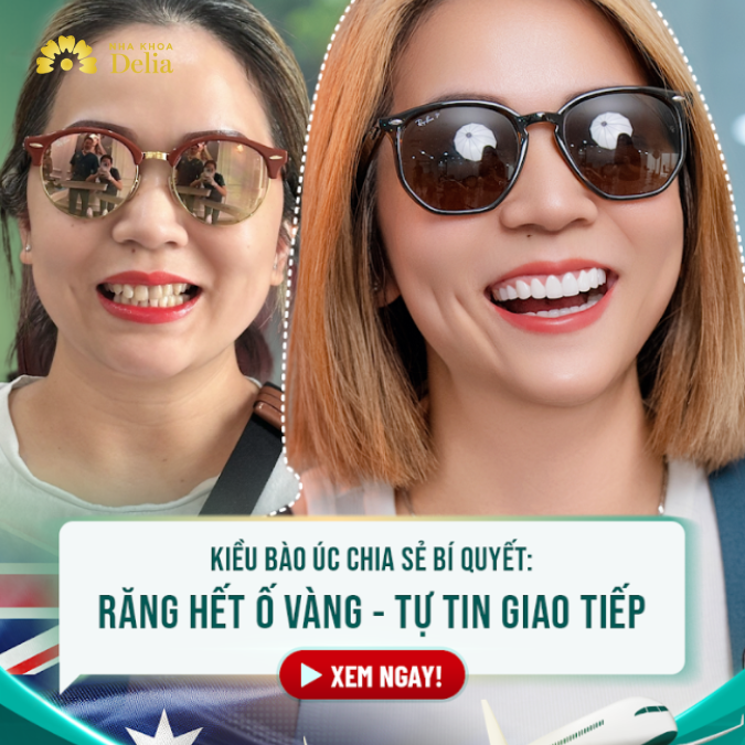 Kiều bào Úc chia sẻ bí quyết răng hết ố vàng, tự tin giao tiếp – Chị Bích Vân