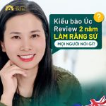 Kiều bào Úc review 2 năm làm răng sứ, mọi người nói gì? - Chị Huệ