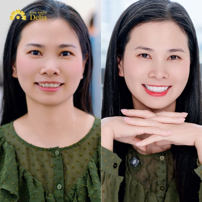 Why choose dental tourism in Philippines for quality care & savings
