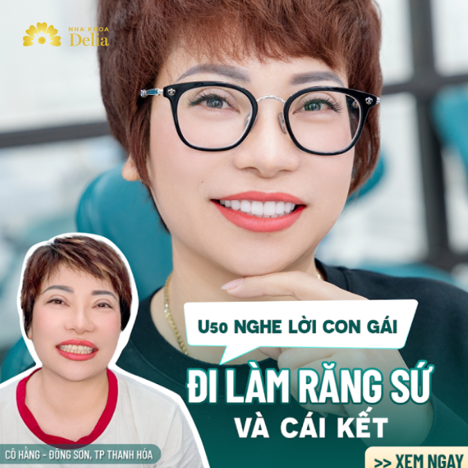 U50 nghe lời con gái đi làm răng sứ và cái kết – Cô Hằng