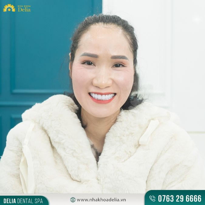Chị Kim Nhung: "Sau khi bọc răng sứ, mọi khuyết điểm về răng miệng của chị đã được khắc phục triệt để. Cảm ơn bác sĩ Delia, đặc biệt là bác sĩ Dũng đã ân cần, chăm sóc chị trong suốt quá trình làm. Với diện mạo mới, chị tự tin hơn và nhất định sẽ gặp được nhiều may mắn trong cuộc sống."